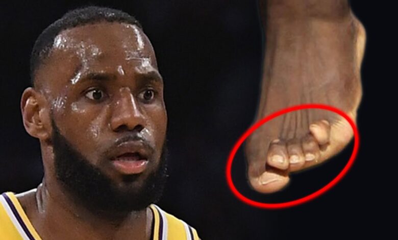 lebron james feet